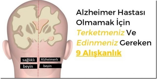 alzheimer-hastasi-olmamak-icin-vazgecmeniz-gereken-9-aliskanlik-1-b